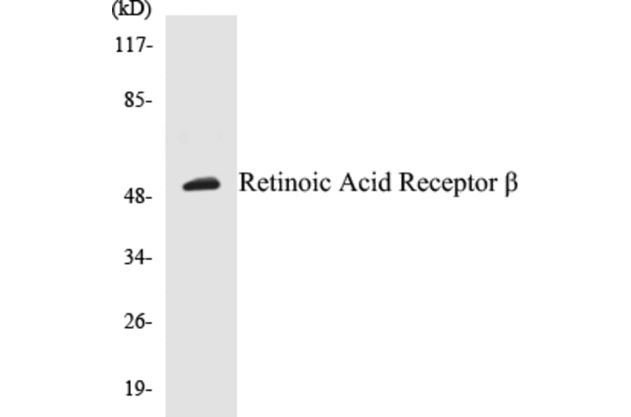 Western Blot - Retinoic Acid Receptor beta Cell Based ELISA Kit (CB5608) - Antibodies.com