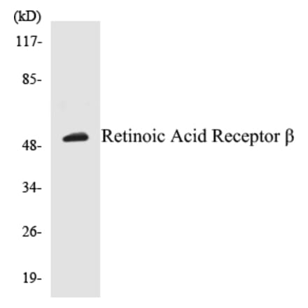 Western Blot - Retinoic Acid Receptor beta Cell Based ELISA Kit (CB5608) - Antibodies.com