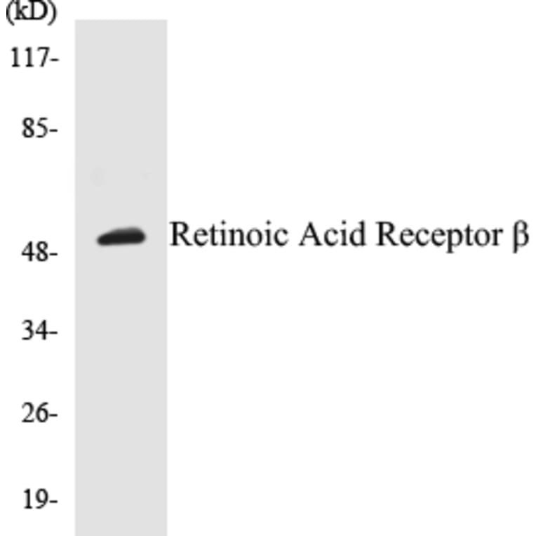 Western Blot - Retinoic Acid Receptor beta Cell Based ELISA Kit (CB5608) - Antibodies.com