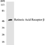 Western Blot - Retinoic Acid Receptor beta Cell Based ELISA Kit (CB5608) - Antibodies.com