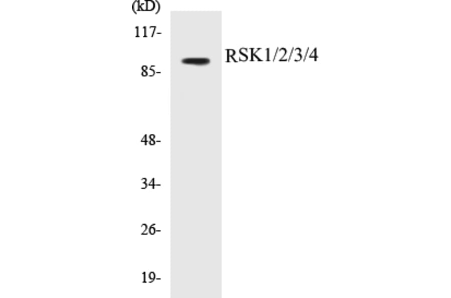 Western Blot - RSK1 + 2 + 3 + 4 Cell Based ELISA Kit (CB5615) - Antibodies.com