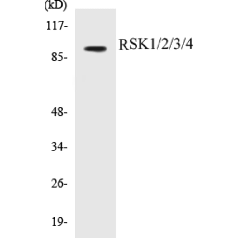 Western Blot - RSK1 + 2 + 3 + 4 Cell Based ELISA Kit (CB5615) - Antibodies.com