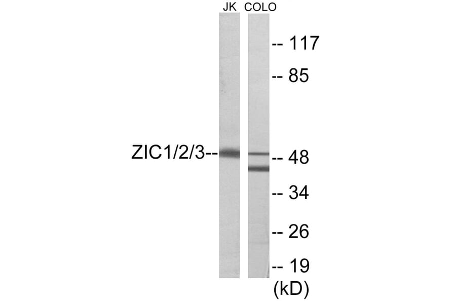 Western Blot - ZIC1 + 2 + 3 Cell Based ELISA Kit (CB5790) - Antibodies.com
