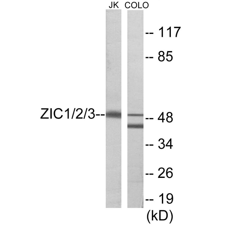 Western Blot - ZIC1 + 2 + 3 Cell Based ELISA Kit (CB5790) - Antibodies.com