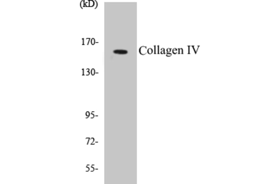 Western Blot - Collagen IV Cell Based ELISA Kit (CB5155) - Antibodies.com
