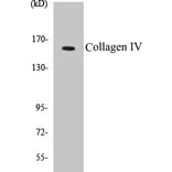 Western Blot - Collagen IV Cell Based ELISA Kit (CB5155) - Antibodies.com