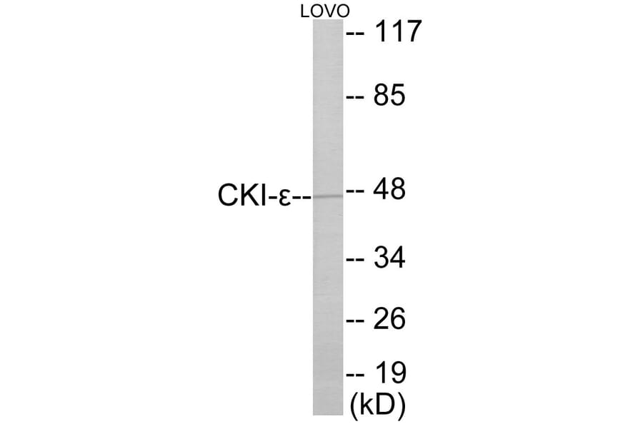 Western Blot - CKI epsilon Cell Based ELISA Kit (CB5900) - Antibodies.com