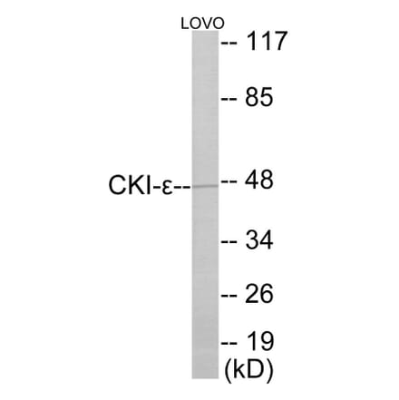 Western Blot - CKI epsilon Cell Based ELISA Kit (CB5900) - Antibodies.com