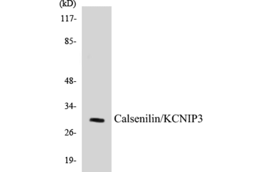 Western Blot - Calsenilin Cell Based ELISA Kit (CB5090) - Antibodies.com
