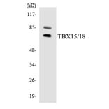 Western Blot - TBX15 + 18 Cell Based ELISA Kit (CB5825) - Antibodies.com