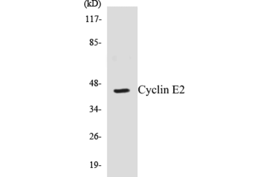 Western Blot - Cyclin E2 Cell Based ELISA Kit (CB5190) - Antibodies.com