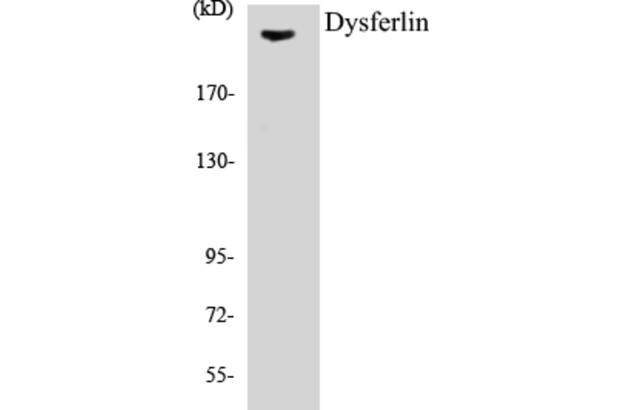 Western Blot - Dysferlin Cell Based ELISA Kit (CB5213) - Antibodies.com