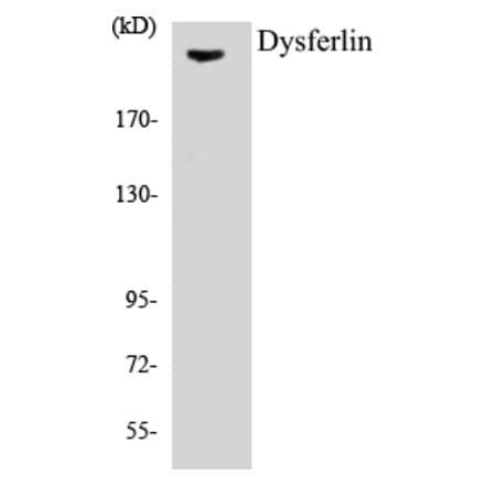 Western Blot - Dysferlin Cell Based ELISA Kit (CB5213) - Antibodies.com