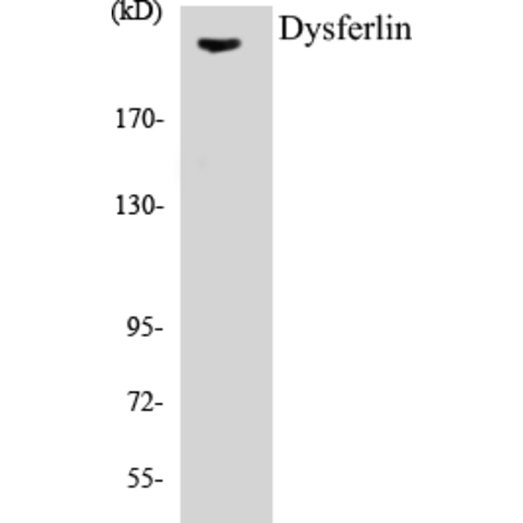 Western Blot - Dysferlin Cell Based ELISA Kit (CB5213) - Antibodies.com