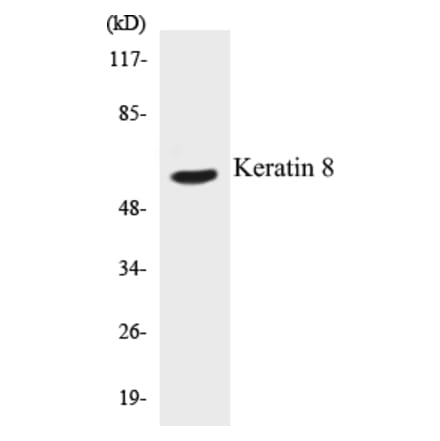 Western Blot - Keratin 8 Cell Based ELISA Kit (CB5402) - Antibodies.com