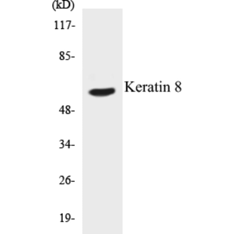 Western Blot - Keratin 8 Cell Based ELISA Kit (CB5402) - Antibodies.com