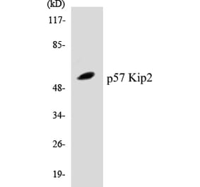 Western Blot - p57 Kip 2 Cell Based ELISA Kit (CB5520) - Antibodies.com