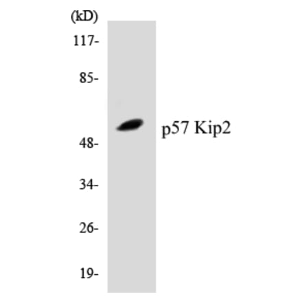 Western Blot - p57 Kip 2 Cell Based ELISA Kit (CB5520) - Antibodies.com