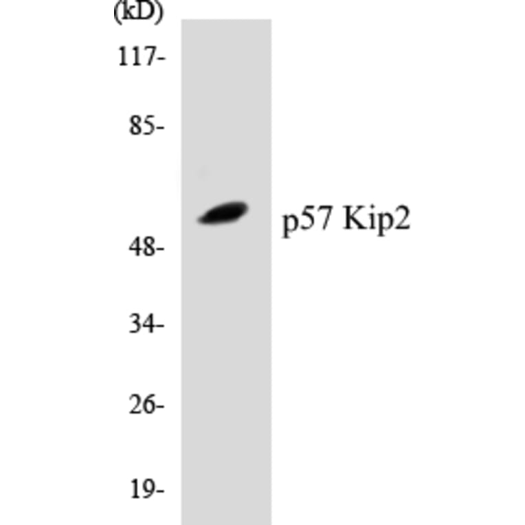 Western Blot - p57 Kip 2 Cell Based ELISA Kit (CB5520) - Antibodies.com