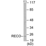 Western Blot - Recoverin Cell Based ELISA Kit (CB5878) - Antibodies.com