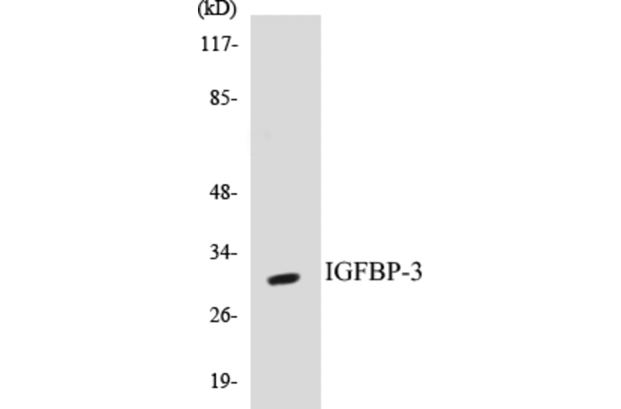 Western Blot - IGFBP-3 Cell Based ELISA Kit (CB5356) - Antibodies.com