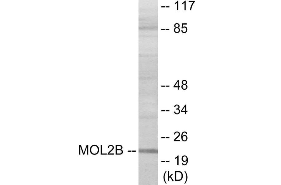 Western Blot - MOBKL2B Cell Based ELISA Kit (CB6070) - Antibodies.com