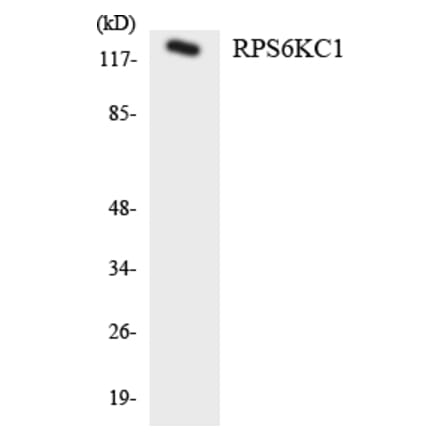 Western Blot - RPS6KC1 Cell Based ELISA Kit (CB6118) - Antibodies.com