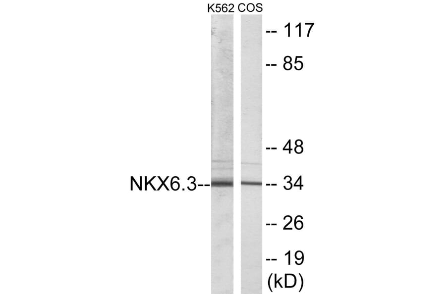 Western Blot - NKX6.3 Cell Based ELISA Kit (CB5762) - Antibodies.com
