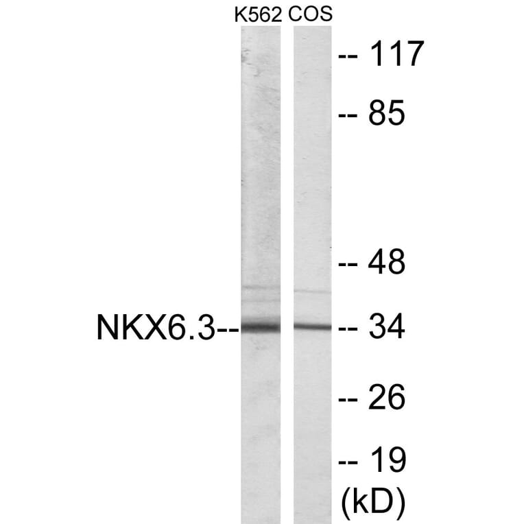 Western Blot - NKX6.3 Cell Based ELISA Kit (CB5762) - Antibodies.com