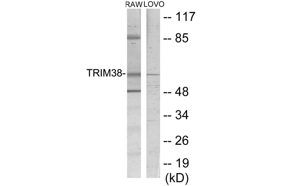 Western Blot - TRIM38 Cell Based ELISA Kit (CB5766) - Antibodies.com