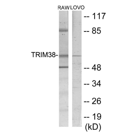 Western Blot - TRIM38 Cell Based ELISA Kit (CB5766) - Antibodies.com
