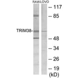 Western Blot - TRIM38 Cell Based ELISA Kit (CB5766) - Antibodies.com