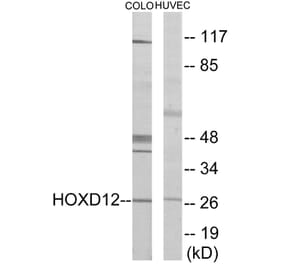 Western Blot - HOXD12 Cell Based ELISA Kit (CB5879) - Antibodies.com