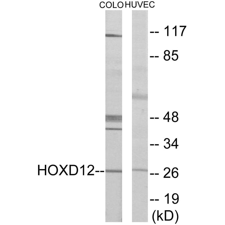 Western Blot - HOXD12 Cell Based ELISA Kit (CB5879) - Antibodies.com