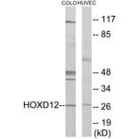 Western Blot - HOXD12 Cell Based ELISA Kit (CB5879) - Antibodies.com