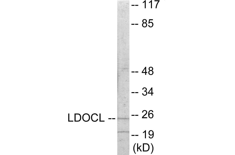 Western Blot - LDOC1L Cell Based ELISA Kit (CB6062) - Antibodies.com