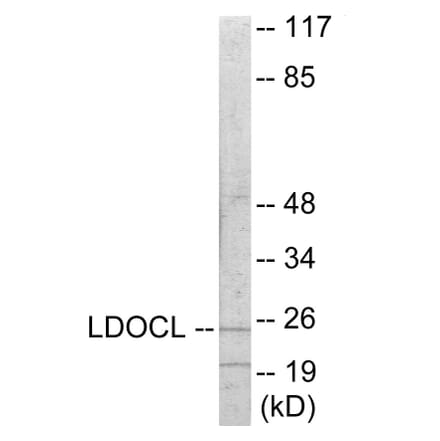 Western Blot - LDOC1L Cell Based ELISA Kit (CB6062) - Antibodies.com