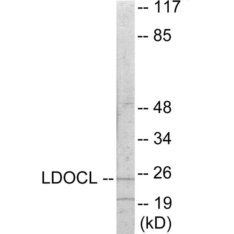 Western Blot - LDOC1L Cell Based ELISA Kit (CB6062) - Antibodies.com