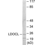 Western Blot - LDOC1L Cell Based ELISA Kit (CB6062) - Antibodies.com