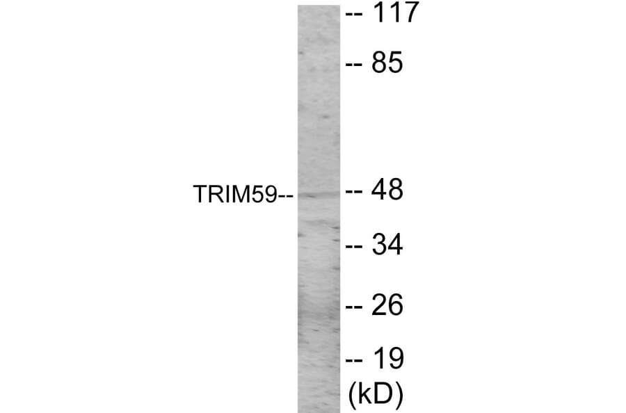 Western Blot - TRIM59 Cell Based ELISA Kit (CB6075) - Antibodies.com