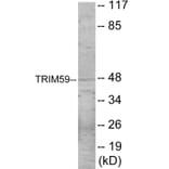 Western Blot - TRIM59 Cell Based ELISA Kit (CB6075) - Antibodies.com