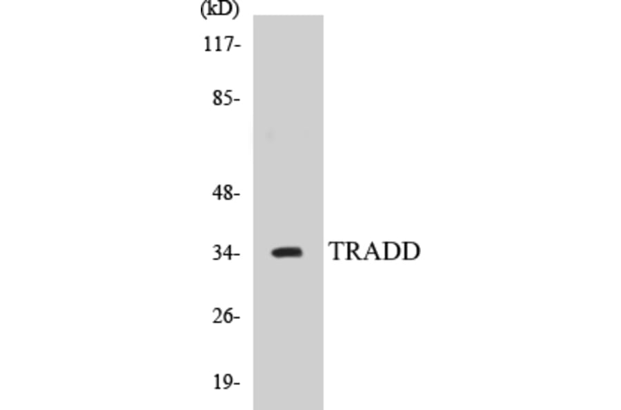 Western Blot - TRADD Cell Based ELISA Kit (CB5701) - Antibodies.com