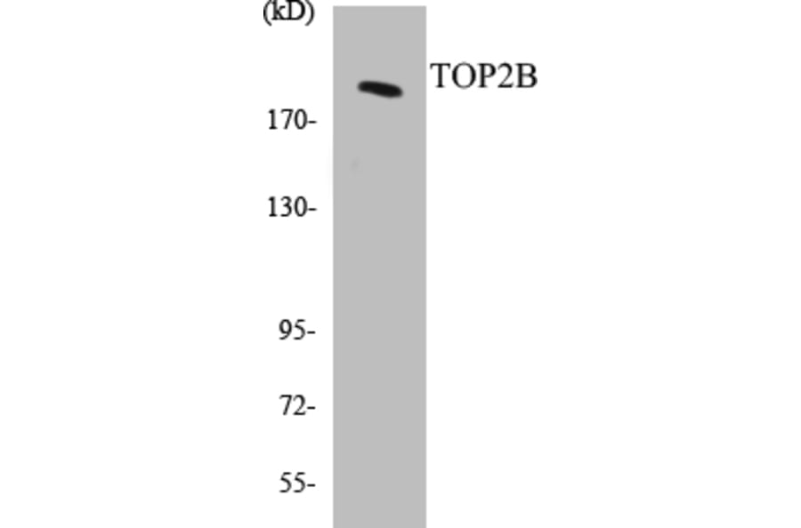 Western Blot - TOP2B Cell Based ELISA Kit (CB5699) - Antibodies.com