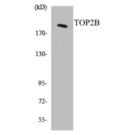 Western Blot - TOP2B Cell Based ELISA Kit (CB5699) - Antibodies.com