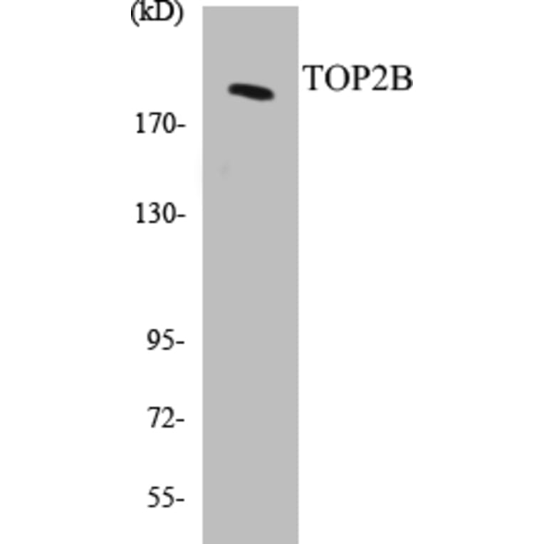 Western Blot - TOP2B Cell Based ELISA Kit (CB5699) - Antibodies.com