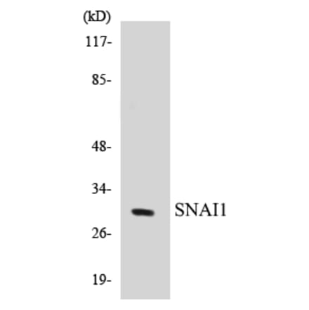 Western Blot - SNAI1 Cell Based ELISA Kit (CB5643) - Antibodies.com