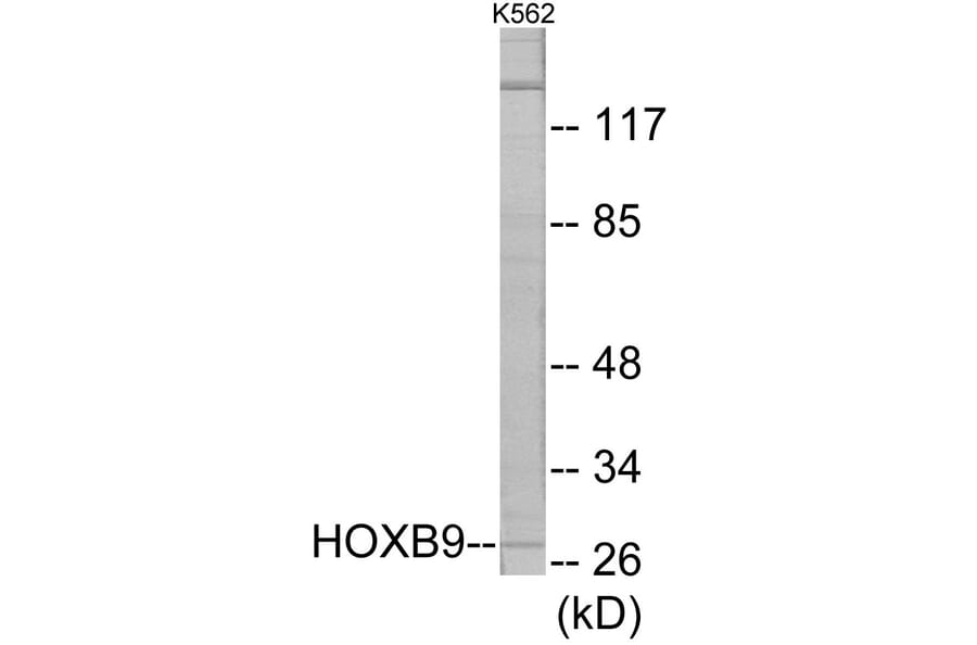 Western Blot - HOXB9 Cell Based ELISA Kit (CB5845) - Antibodies.com