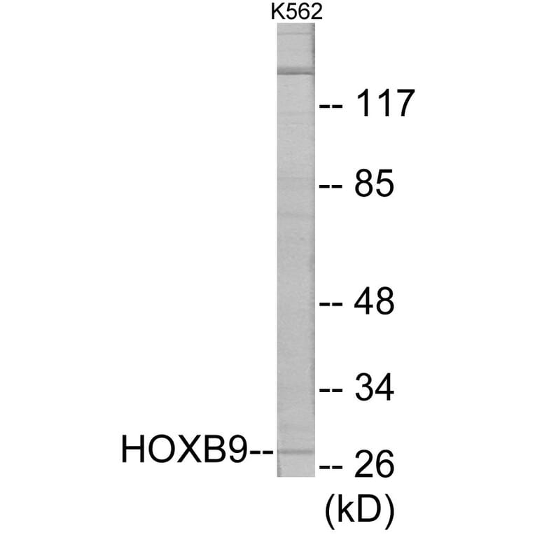 Western Blot - HOXB9 Cell Based ELISA Kit (CB5845) - Antibodies.com
