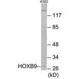 Western Blot - HOXB9 Cell Based ELISA Kit (CB5845) - Antibodies.com