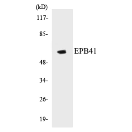 Western Blot - EPB41 Cell Based ELISA Kit (CB5230) - Antibodies.com